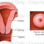 LEEP – Presurgical instructions - image