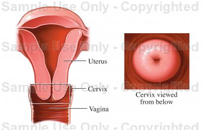 LEEP – Presurgical instructions - image