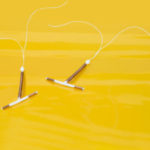 IUD insertion – What to expect? - image